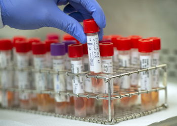 Coronavirus: Obuasi Residents Shy Away From Testing