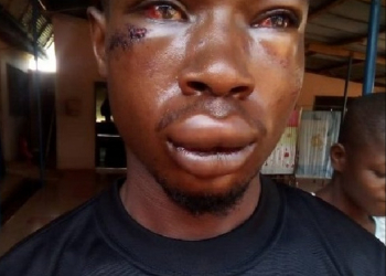 University of Education Student Beaten for Flirting with CID Officer’s Wife